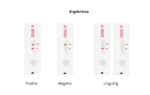 Hotgen Softpack Antigen Schnelltes